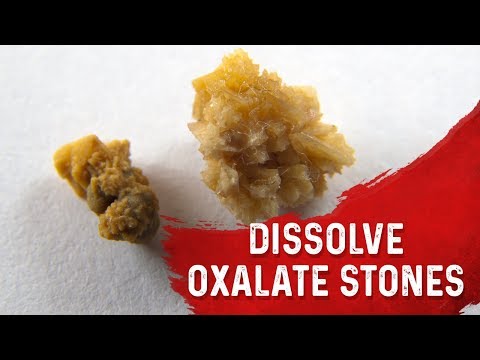 The Top SUPERFOODS for the Kidneys—Explained by Dr Berg