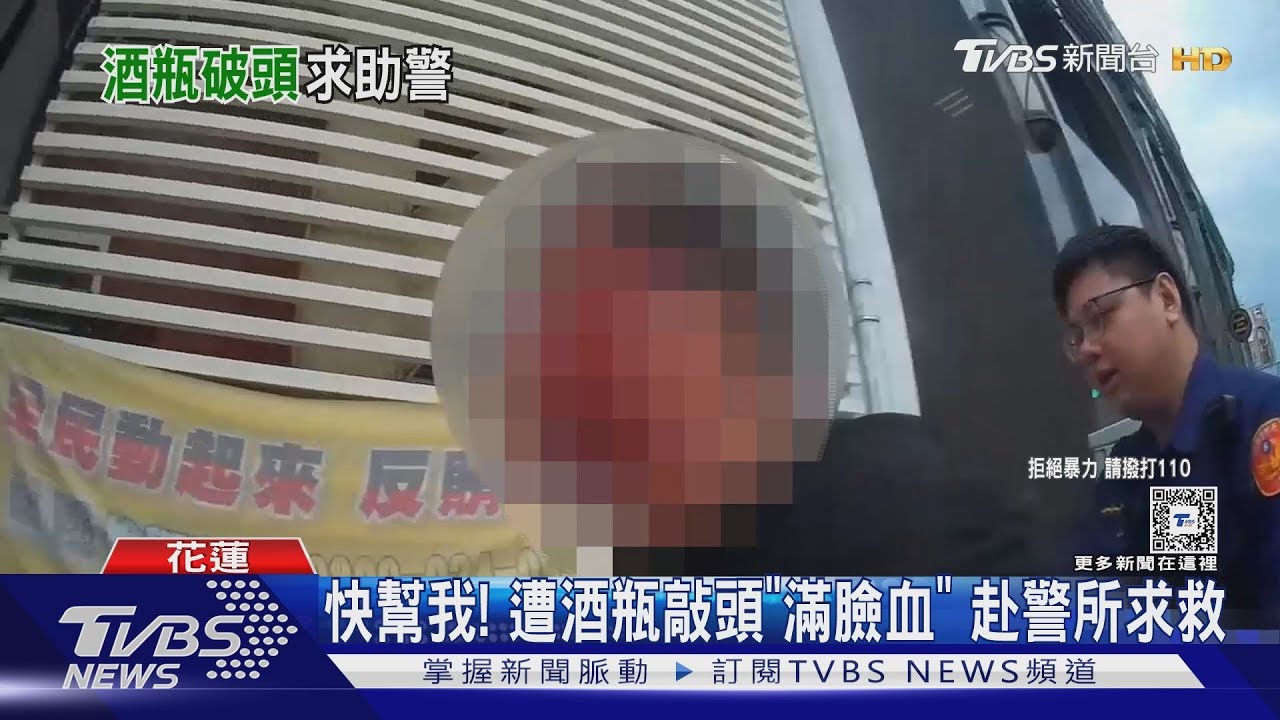 快幫我! 遭酒瓶敲頭「滿臉血」赴警所求救