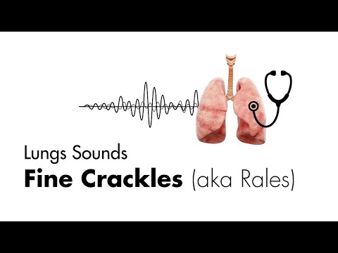 Fine Crackles (Rales) - Lung Sounds - MEDZCOOL