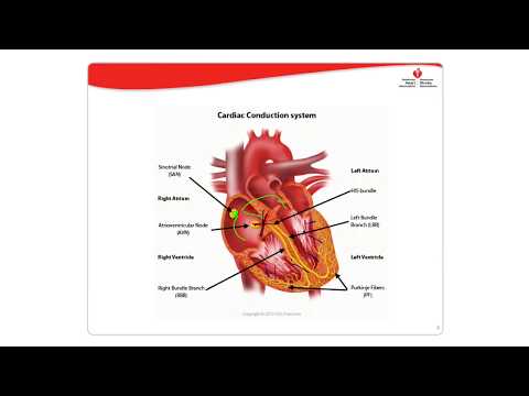 Dysrhythmia Management