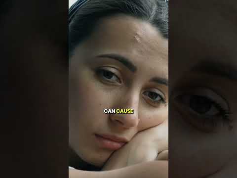 Chocolate and Acne are they even related? || Skinethics Pune || Pallavi Ahire Shelke