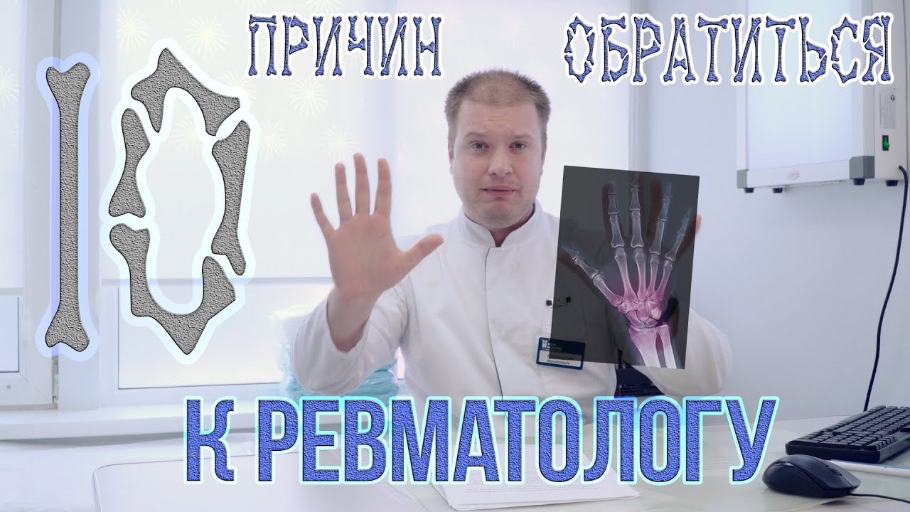 Севостьянов ревматолог. Ревматолог солнцева. Ревматолог солнцева. Ревматолог солнцева. Врач ревматолог.