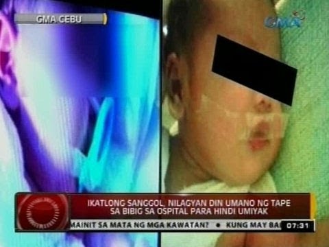 Kaysa tratuhin ang mga kuko ang layo mula sa balat Analogue sangkap Lotseril