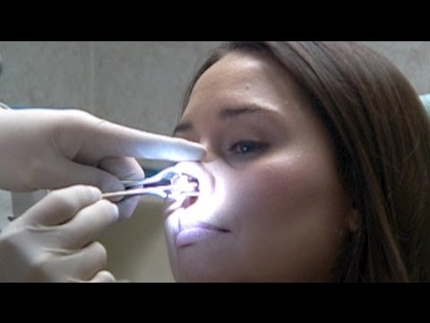 Diffondere modifiche prostata Prezzo vitaprost di candele e tablet