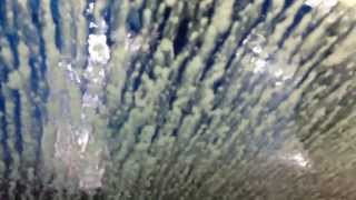 Car Wash Pneumonia Blues