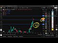 ATHA Stock Athira Pharma Stock ATHA Stock PREDICTION ATHA STOCK Analysis ATHA Stock News Today
