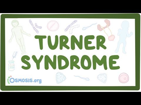 Turner syndrome (Year of the Zebra)