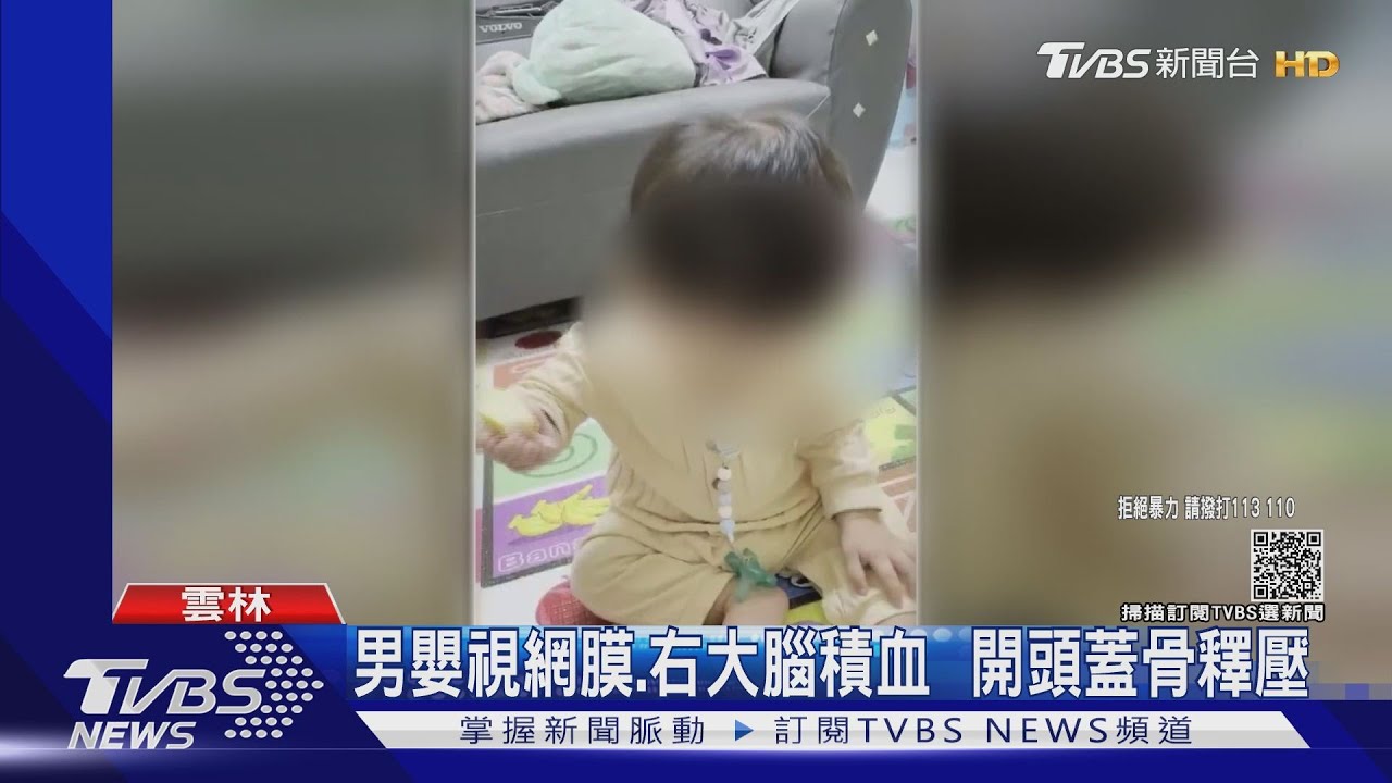 11月大男嬰顱內出血開刀　無照保母涉虐