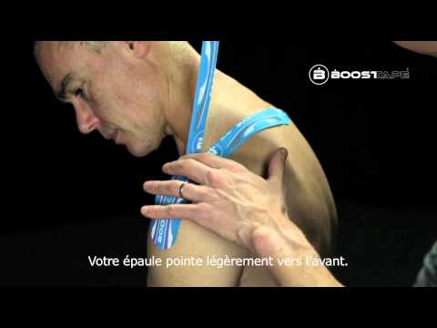 comment soigner tendinite long biceps