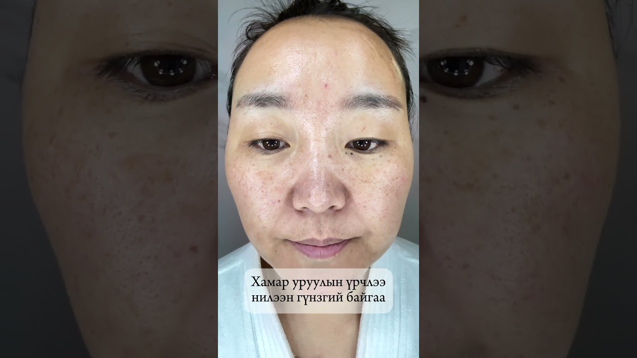 #homebeauty Олон үйлдэлт эмчилгээний аппарат