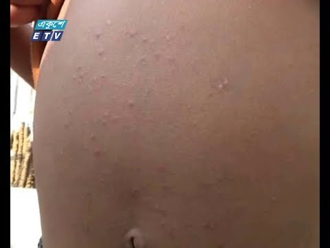 আর্সেনিক ঝুঁকিতে রাজবাড়ি