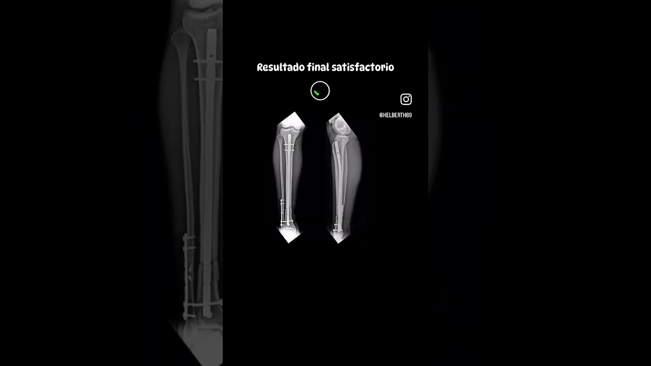 Helberth Augusto González Rico-6