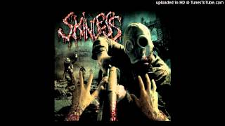 Skinless - Spoils of the Sycophant