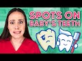 What Are Spots on Baby's Teeth?