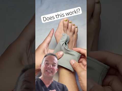 Do Bunion Splints Work?!