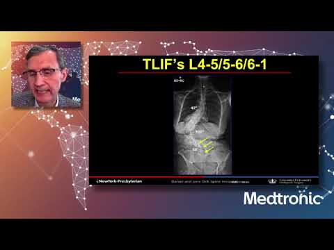 Lecture: Rod Application and Correction Maneuvers