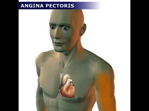 angina pectoris és magas vérnyomás kezelésére szolgáló gyógyszerek