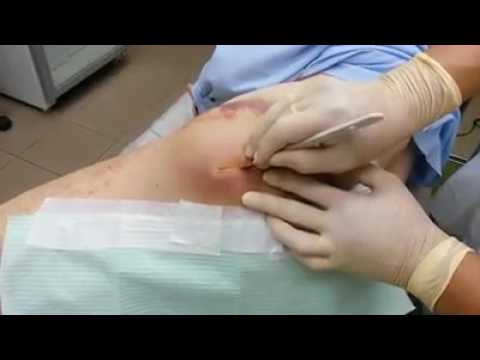 Kung paano mawalan ng timbang sa pamamagitan ng 5 kg kung mayroon lamang mansanas Mawalan ng Timbang sa isla