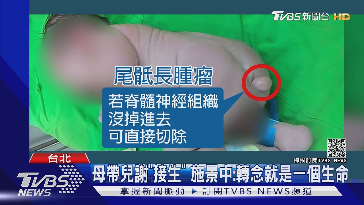 驚!寶寶竟長「橢圓尾巴」 台大醫切除曝近況:長大還會3語言