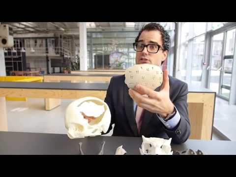 Maikel Beerens — Maikel Beerens (Xilloc): 'Alleen als je doorzet, slaag je in