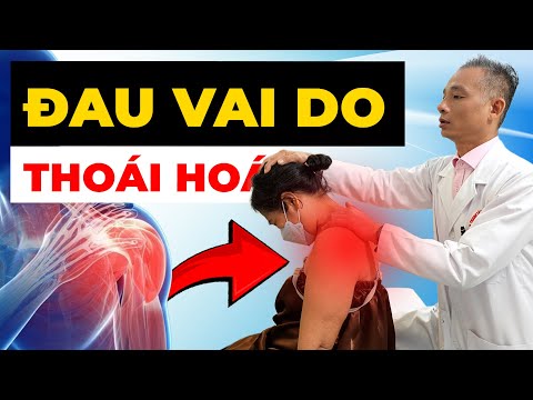 Đau Vai Không Thể Ngủ, Khó Cử Động? Thoái Hóa Khớp Vai Đang Hành Hạ Bạn