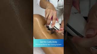 WOOOW! Anticellulite massage for you body #beauty #massage #cellulite  #spa #woman #beauty