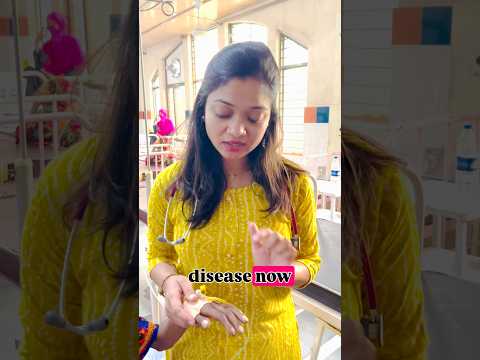 Trommelschlägelfinger bei einem Kind mit Morbus Wilson #trending #pediatrics #clubbing #babycare ...