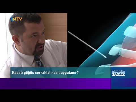 Göğüs Cerrahisinde Endoskopik Yöntemler