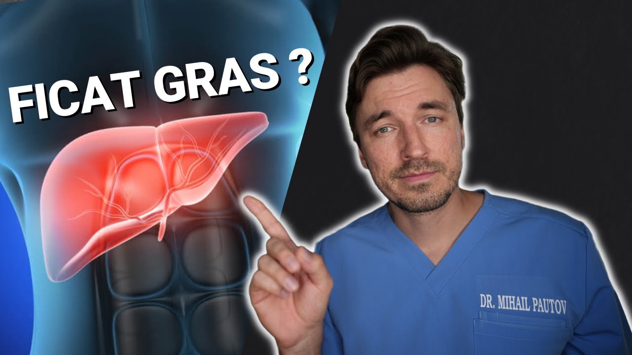 7 REGULI pentru un FICAT GRAS 👨🏼‍⚕️- experienta unui chirurg