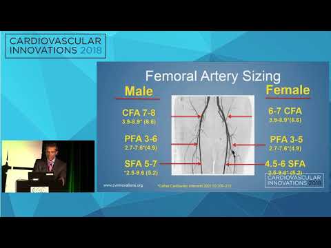 CVI2018 Session: Technical tips on angioplasty and sizing, master's approach