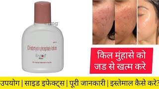 Erytop Lotion is an effective medicine for treating pimples and acne. Uses, Benefits, Side Effect...