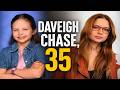 Daveigh Chase Lilo Stitch Voice Actress Dies At 35 2026