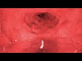 Ambient Gurgles Ultimate Sleep Audio
