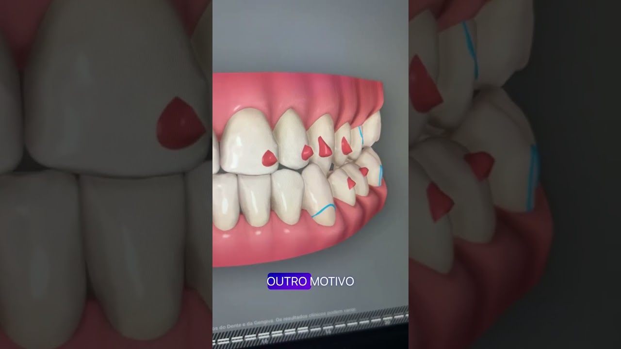 Éberson Luis Marques Sasso-14