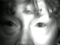 Intermittent Square Wave Jerks