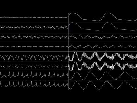Sinc-X - Time Warp (Oscilloscope View)
