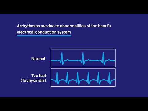 Pediatric Arrhythmia