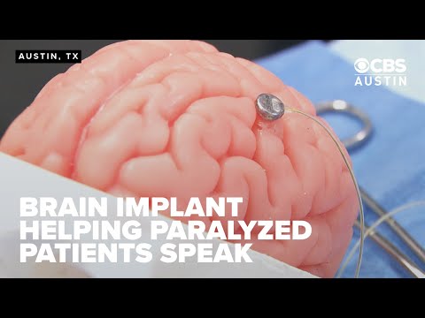 Austin's Paradromics advances Brain-Computer Interface with ...
