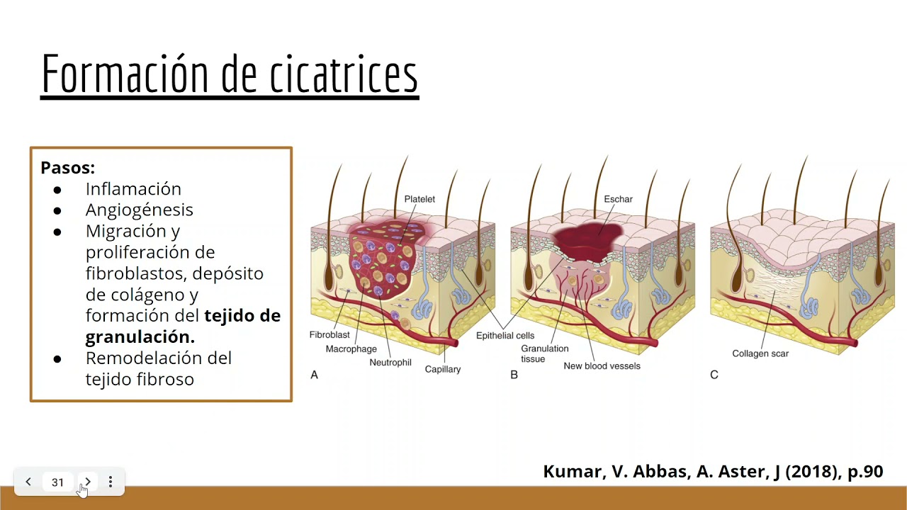 Reparación y cicatrización tisular