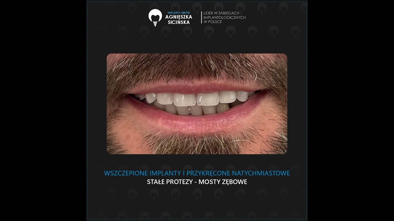 Agnieszka Ewa Sicińska-56