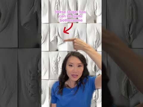 Do You Have A Normal Labia??