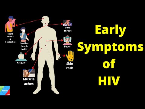 What are the Early Signs and Symptoms of HIV infection? - HIV/AIDS