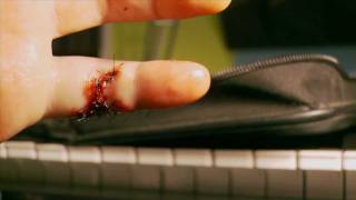 Cut Finger - Severed Nerve - Blood - New Year's Day Finger Flight Aftermath