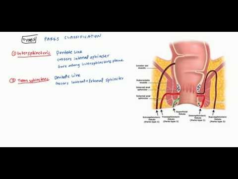 Anal Fistulas Lecture for USMLE Step 2