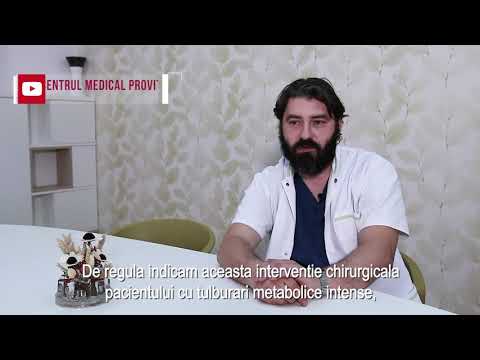 Cand se recomanda bypass-ul gastric?