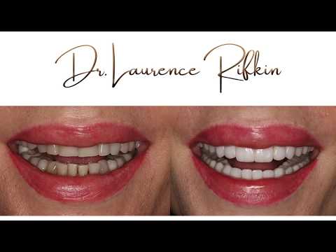 Cosmetic Smile and Reconstruction
