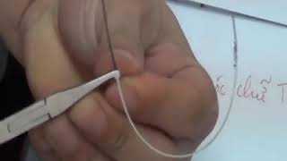 BẺ TLOOP - ĐÓNG KHOẢNG