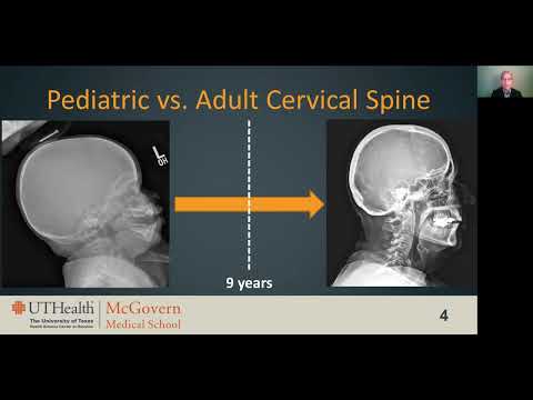 Pediatric Cervical Spine Trauma | Free Radiology CME
