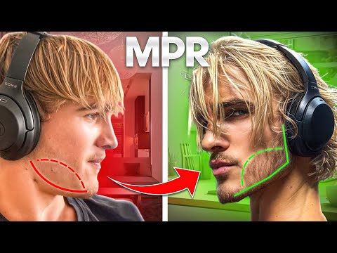 WHY YOUR JAWLINE SUCKS (MPR TUTORIAL)