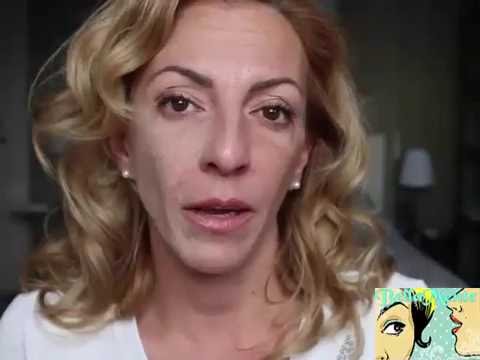 Pigmentazione di pelle e partenza Rimedio di gente da posti di pigmentary senili